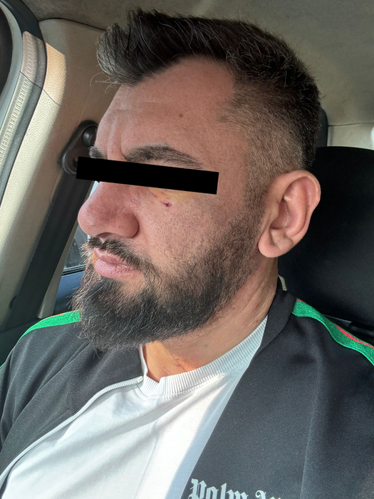 Nepotul lui Daniel Onoriu, Moise Iosif, bătut măr de un bodyguard