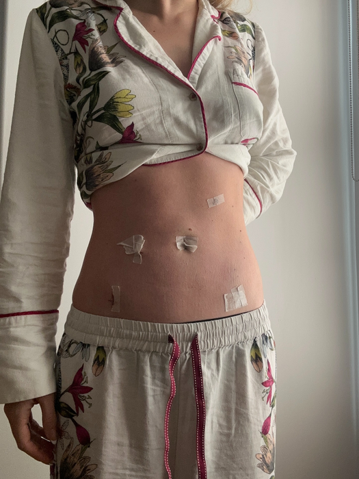 Diagnosticul primit de o celebră actriță! Suferă de o boală cronică: „Nu există niciun leac și nicio ameliorare pe termen lung”