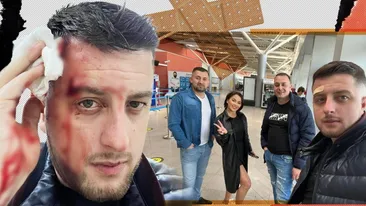 L-a umplut de sânge în local! Imagini de coșmar cu saxofonistul lui Carmen de la Sălciua: 4 copci și dosar penal!