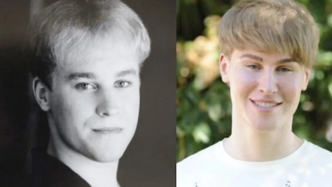 E obsedat de Justin Bieber! Cum arată acest băiat, după ce si-a facut zeci de operatii ca să semene cu idolul lui