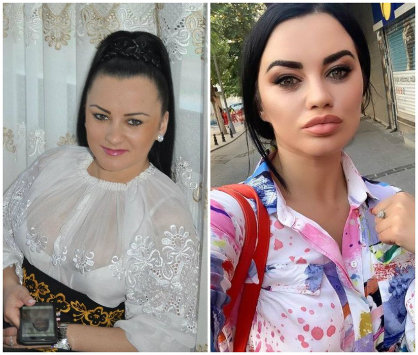Carmen de la Sălciua, înainte și după operații