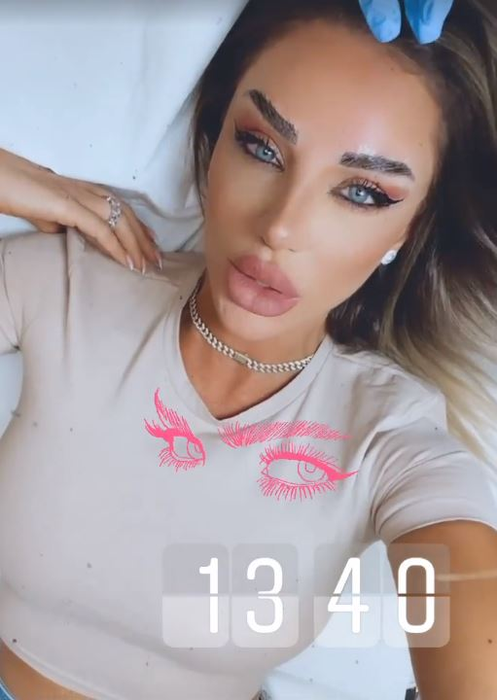 Bianca Drăgușanu, problemă delicată după o intervenție estetică: “Ce mi-o fi trebuit mie implant de sprâncene? O porcărie”