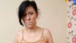 NIMENI nu poate ghici cati ani are aceasta femeie! BOALA ciudata care o face sa arata asa