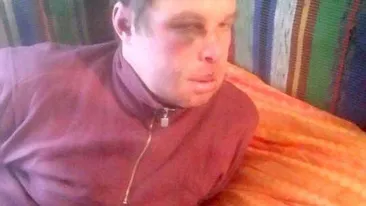 IMAGINI ŞOCANTE. Scene de Local Kombat la Spitalul de Psihiatrie din Iaşi. Un bolnav a fost stâlcit în bătăie