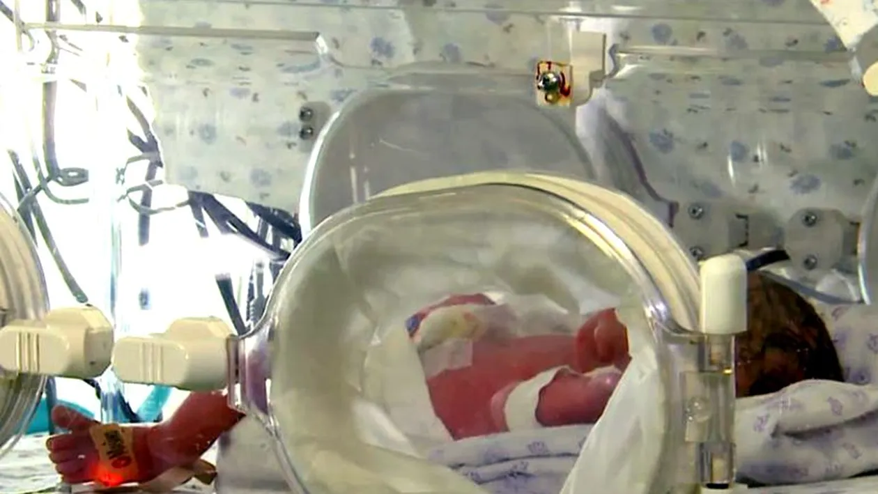 Caz unic în istoria omenirii: S-a născut primul bebeșul fără chip