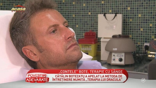 Botezatu a apelat la un tratament rupt din seria "Twilight"! Îşi injectează propriul sânge în faţă pentru un ten cât mai tănăr!