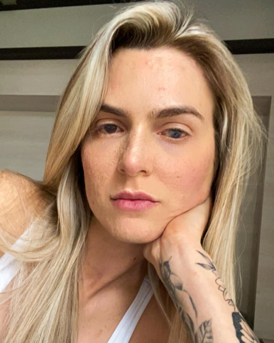 Această femeie a ajuns în comă, după ce a luat un medicament banal/ Sursa foto: Instagram