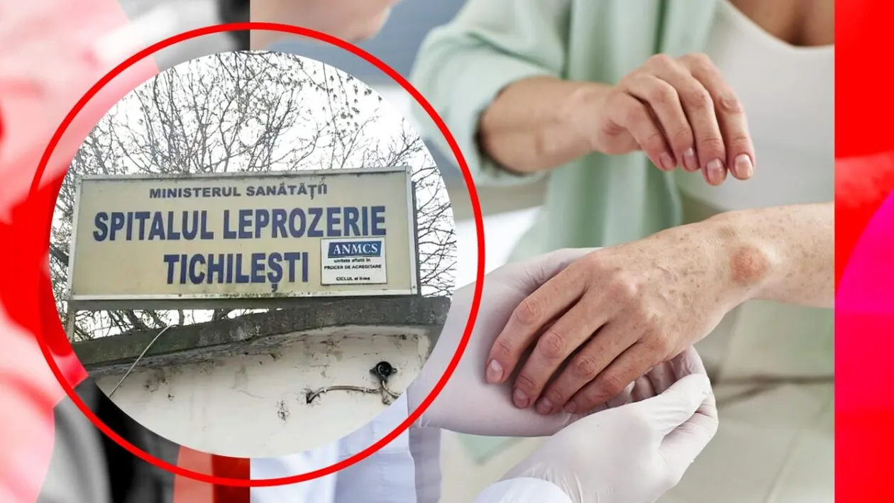 Leprozeria de la Tichilești: de la inaugurare la revoltă. Un episod șters din memoria României