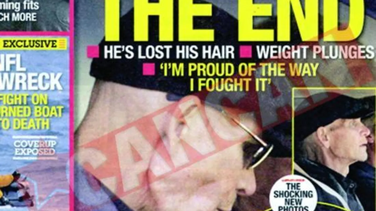 Patrick Swayze a slabit peste 40 de kilograme