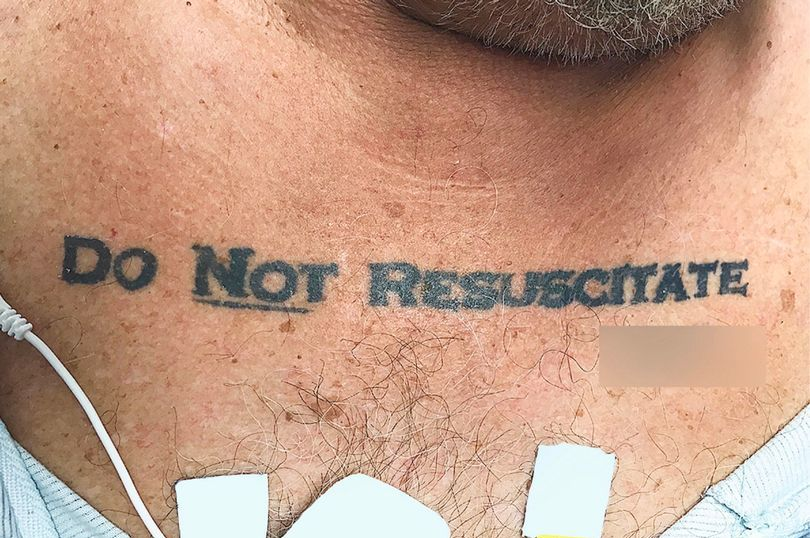 Un bărbat a ajuns în stare gravă la spital, iar medicii au rămas şocaţi după ce au văzut ce tatuaj avea pe piept