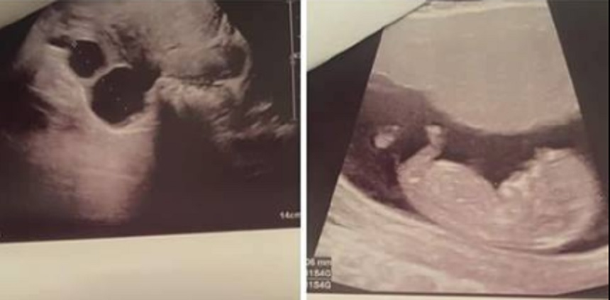 Sora Mariei Constantin este însărcinată pentru prima dată. Sursa foto: Facebook