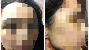 Povestea cutremuratoare a tinerei care a fost sclava sexuala timp de 6 ani! A fost sechestrata de la 14 ani si desfigurata de cel care ii era iubit
