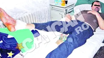 Un politist de frontiera din Suceava a fost ranit in picior de un coleg de breasla. Impuscat pentru ca a fugit de la locul accidentului