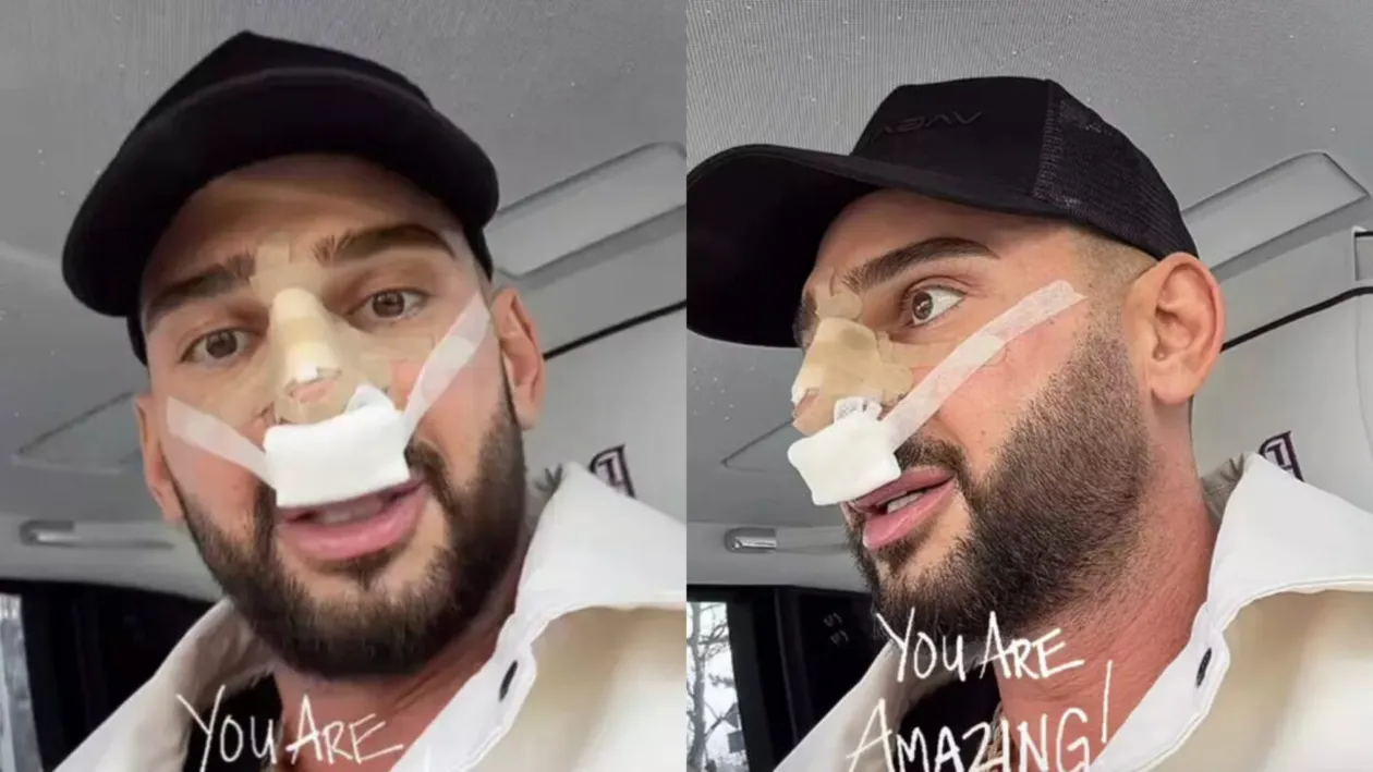 Cum arată nasul lui Dorian Popa, la 12 zile de la intervenție. Artistul a publicat prima imagine