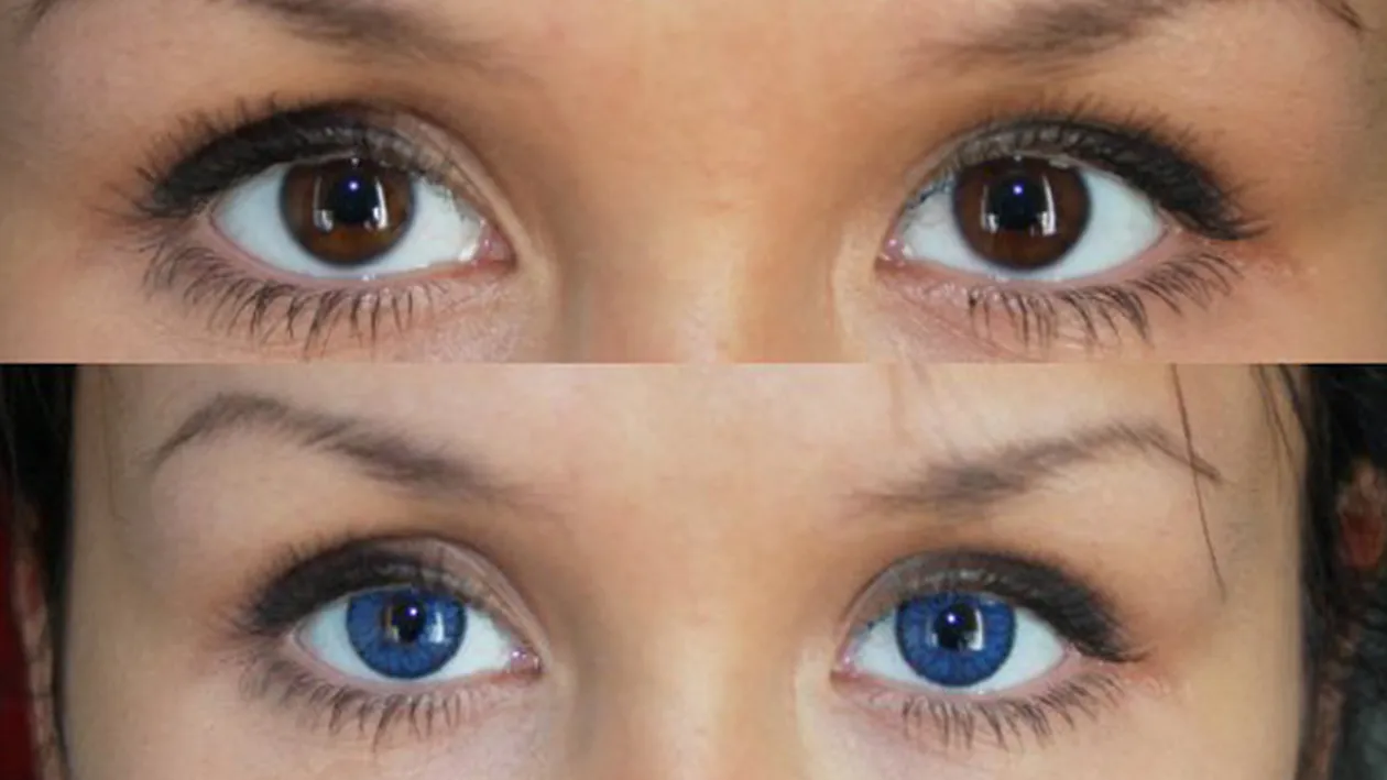 Porti lentile de contact? O femeie a fost la un pas de a-si pierde vederea din cauza lor