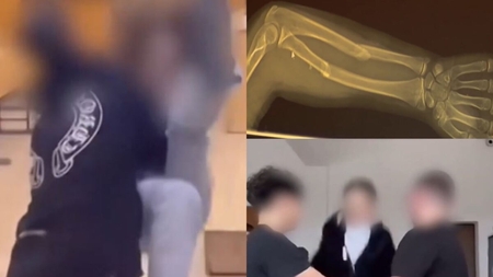 Superman Challenge, provocarea de pe Tik Tok, a băgat zeci de adolescenți în spital