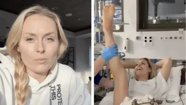 Legendara schioare Lindsey Vonn, la un pas să-i fie amputat piciorul după acidentarea de la Jocurile Olimpice. Cum au salvat-o medicii