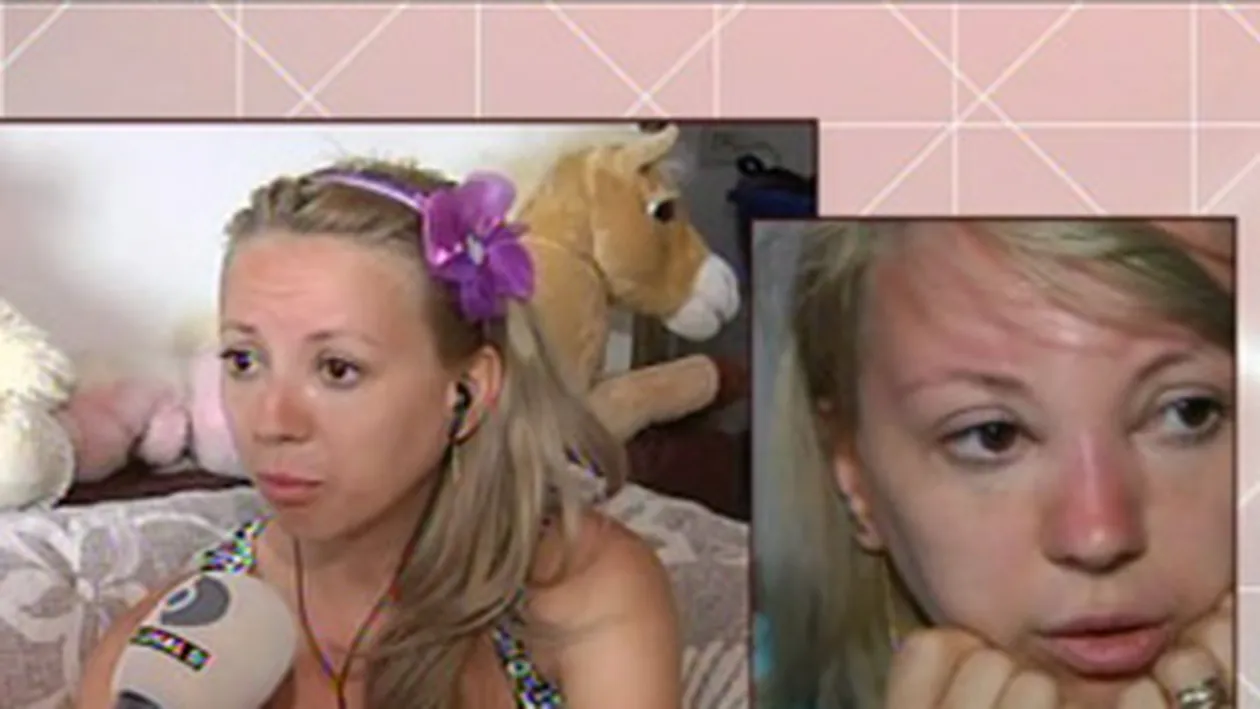 Atentie cat va expuneti la plaja! Larisa Dragulescu, tumefiata din cauza soarelui!