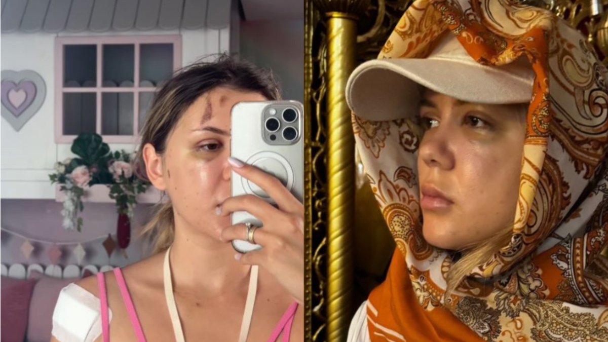 Prima imagine cu Emily Burghelea după ce a ieșit din operație. Fanii s-au cutremurat când au văzut-o