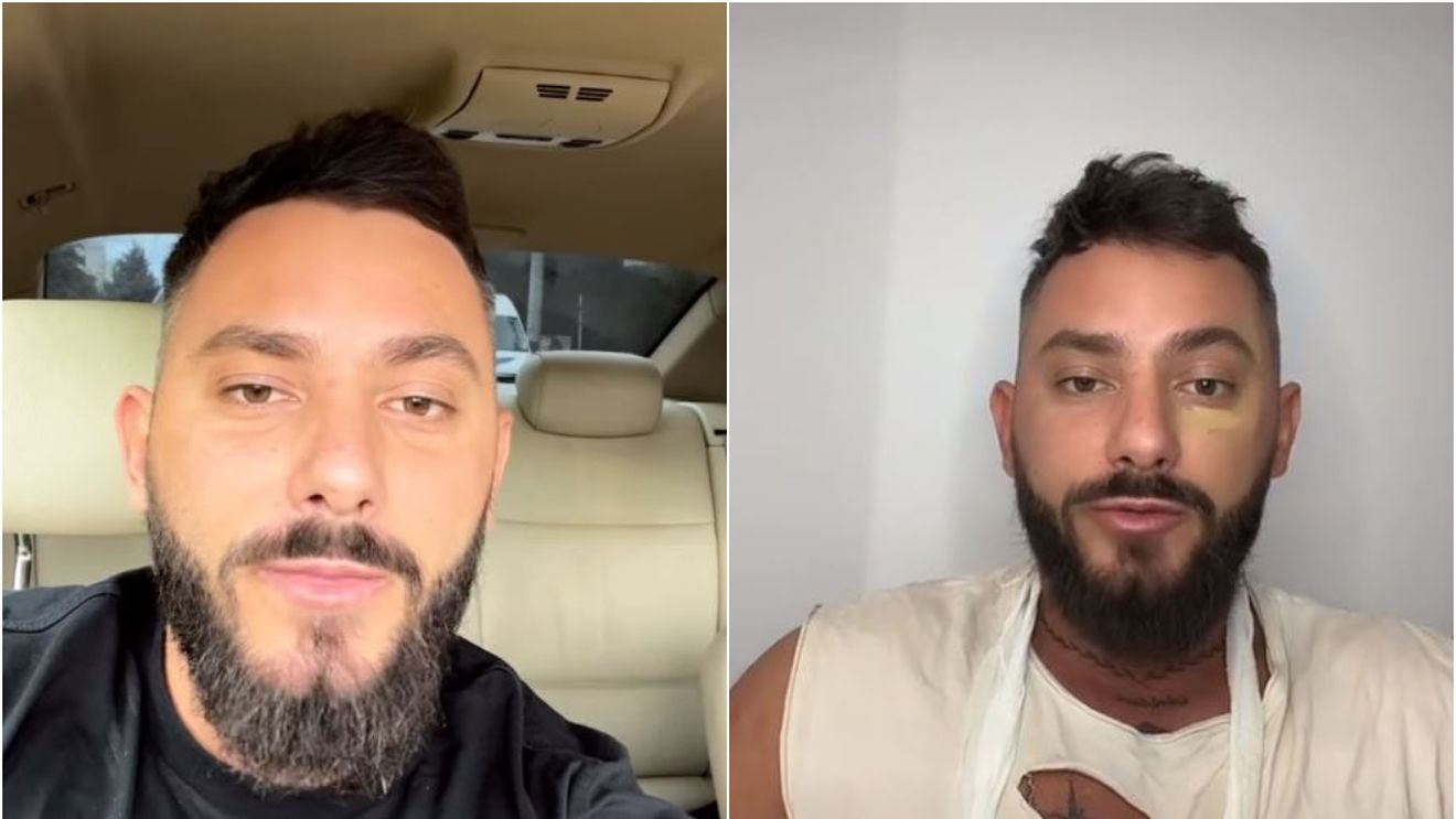 Romeo Vasiloni s-a tunat, după finala Insula Iubirii! La ce intervenție a apelat ispita: „Recomand tuturor bărbaților!”