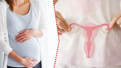 Femeie născută fără uter, însărcinată după ce a primit un transplant de la sora ei. A ajuns în săptămâna 26 de sarcină