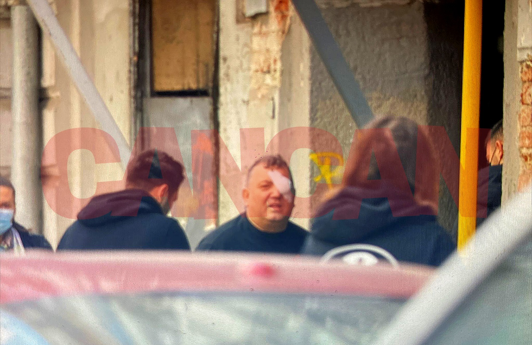 Nuredin Beinur, după ce a primit îngrijiri medicale (Foto: CANCAN.RO)