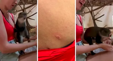 Vedeta din România care a fost mușcată de maimuțe în vacanță: „Nu am fost la doctor. Mi-a zis ChatGPT să stau liniștită”