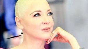 Celebra EDITH GONZALES îşi revine miraculos în lupta cu cancerul! După ce a renunţat la peruci, actriţei a început să îi crească din nou părul  