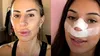 Val de reacții după ce o influenceriță s-a operat, pentru ca viitorii copii să nu îi moștenească nasul