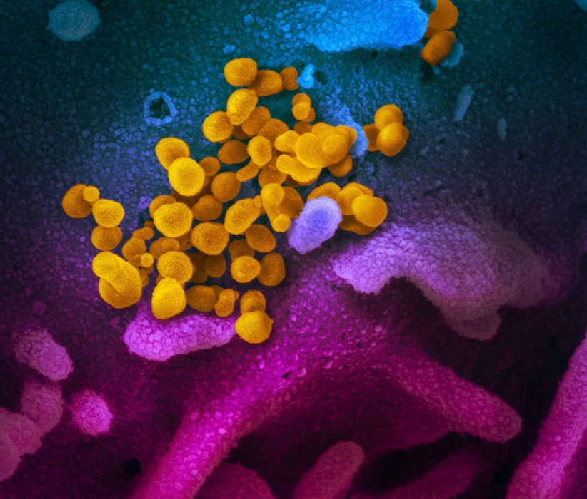 epa08252653 An undated handout picture made available by the National Institutes of Health (NIH) shows a scanning electron microscope image of the SARS-CoV-2 (yellow) -- also known as 2019-nCoV, the virus that causes COVID-19 -- isolated from a patient in the USA, emerging from the surface of cells (blue/pink) cultured in the lab (issued 27 February 2020). The novel coronavirus is on the verge of spreading across the world as more cases are emerging outside China with outbreaks in South Korea, Italy and Iran.  EPA/NIAID- RML/NATIONAL INSTITUTES OF HEALTH HANDOUT  HANDOUT EDITORIAL USE ONLY/NO SALES