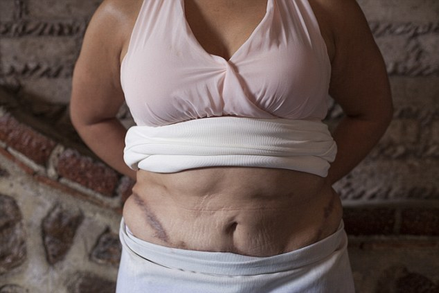 „Măcelarul operaţiilor estetice“ a lăsat zeci de femei marcate pe viaţă. Cum arată după ce au fost ciopârţite cele care sperau să devină frumoase | FOTO