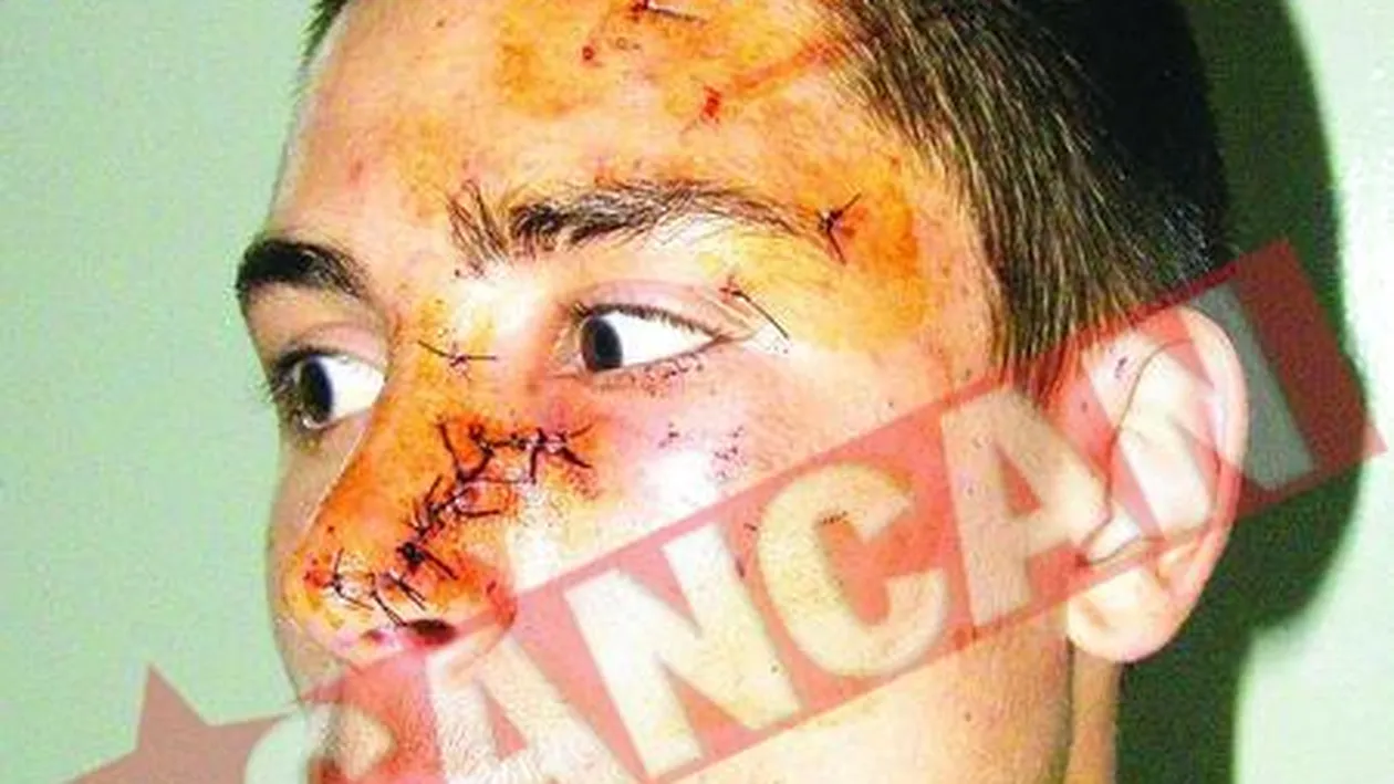 Mutilat cu un ciob, la discoteca