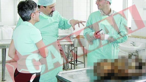 A facut hepatita din cauza formolului
