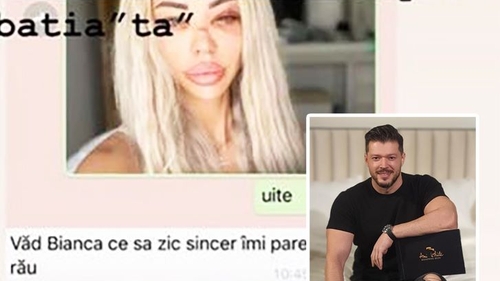 Prima reacție a lui Victor Slav, după ce Bianca Drăgușanu a fost desfigurată de Alex Bodi: ”Pam, Pam”