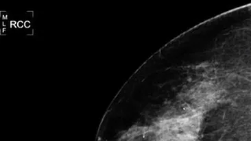 Se reprofilzeaza NASA?! Mai nou face si mamografii, folosind tehnologia pentru studierea cosmosului