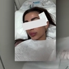 O fostă jurnalistă din România a fost diagnosticată cu cancer de piele. Ce mesaj a transmis de pe patul de spital