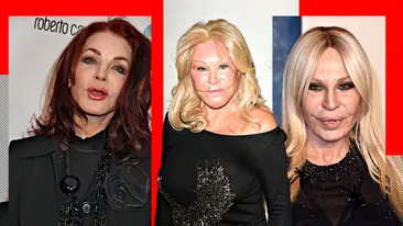 TOP 5- Vedete de la Hollywood care s-au ales cu chipul desfigurat în urma operațiilor estetice. Jocelyn Wildenstein sau Donatella Versace arată de nerecunoscut!
