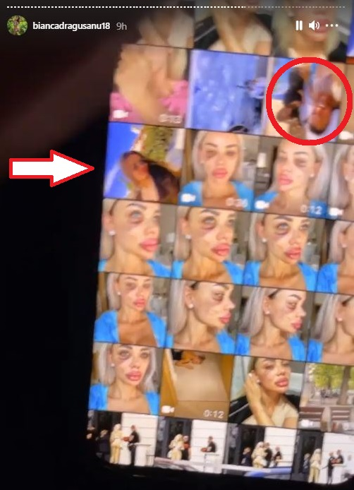 Bianca Drăgușanu a arătat din greșeală înregistrarea cutremurătoare în care este leșinată lângă pat: “Am trăit în casă cu un om care mă filma non stop! Nu ți se pare că ăsta e șantaj?!”