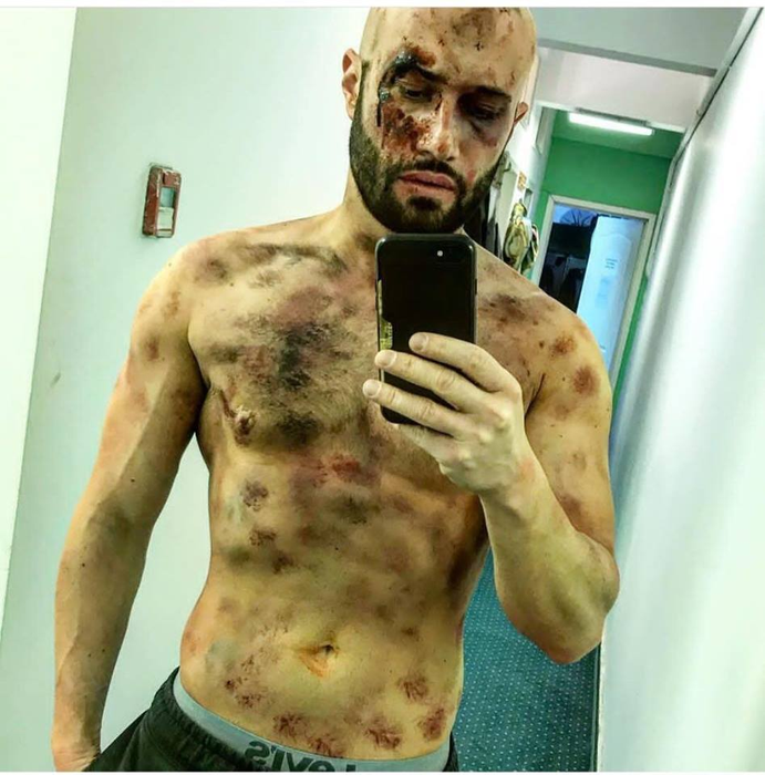 Bendeac a recunoscut că depresia l-a adus în pragul sinuciderii de trei ori