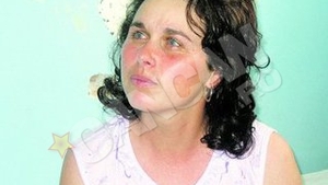 Primul caz de West Nile din 2011 a aparut la Galati! Au revenit "tantarii ucigasi"!
