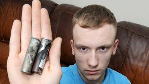 Ştiai că ţi se poate întâmpla asta? Acest tânăr a suferit un accident horror, după ce ţigara electronică i-a explodat în buzunar | FOTO