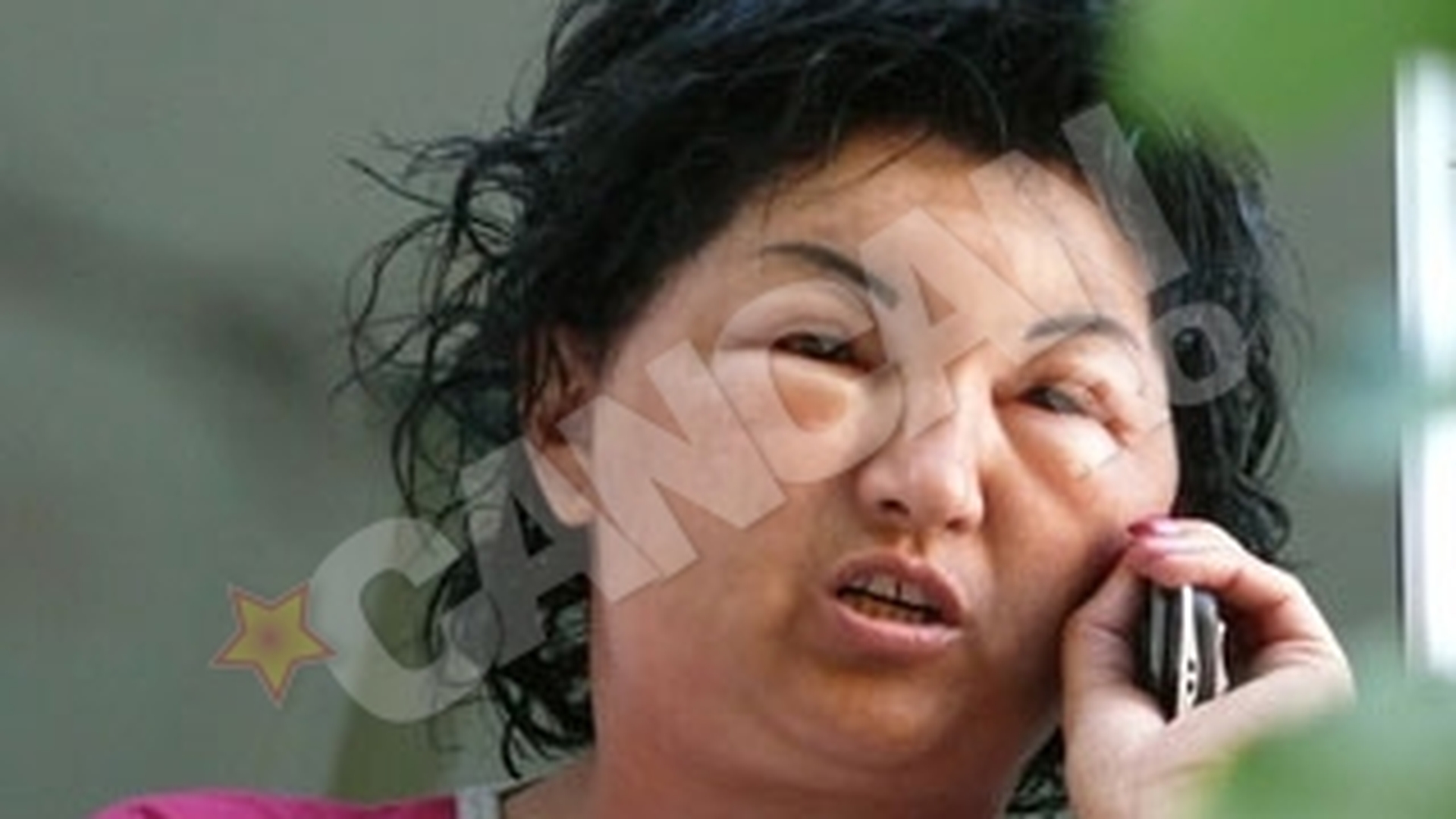 O femeie din Mehedinti a ajuns la Urgenta, mutilata de cosmetice! Vopseaua folosita era expirata!