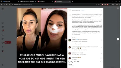Influencerița care și-a făcut rinoplastie pentru ca viitorii săi copii „să nu îi moștenească nasul”. Ideea a primit replici pe măsură: „La o operație pe creier te-ai gândit?”