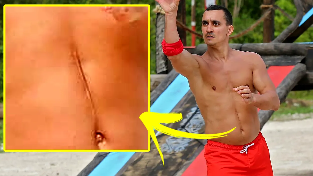 Am aflat adevărul! De unde provine cicatricea imensă de pe abdomenul lui Marian Drăgulescu de la Survivor România