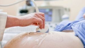 Era în culmea fericirii când a aflat că va deveni mamă, dar din cauza sărăciei nu a reuşit să-şi facă nicio ecografie pe timpul sarcinii. Când a născut a rămas fără cuvinte! Uite ce a adus pe lume