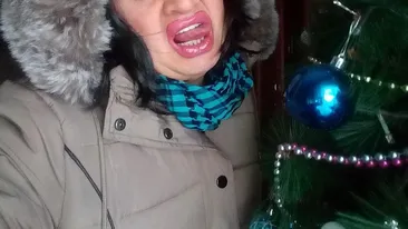 Cristi din Banat, ”torturat” de medicul estetician. ”Doar supă pot suge...”