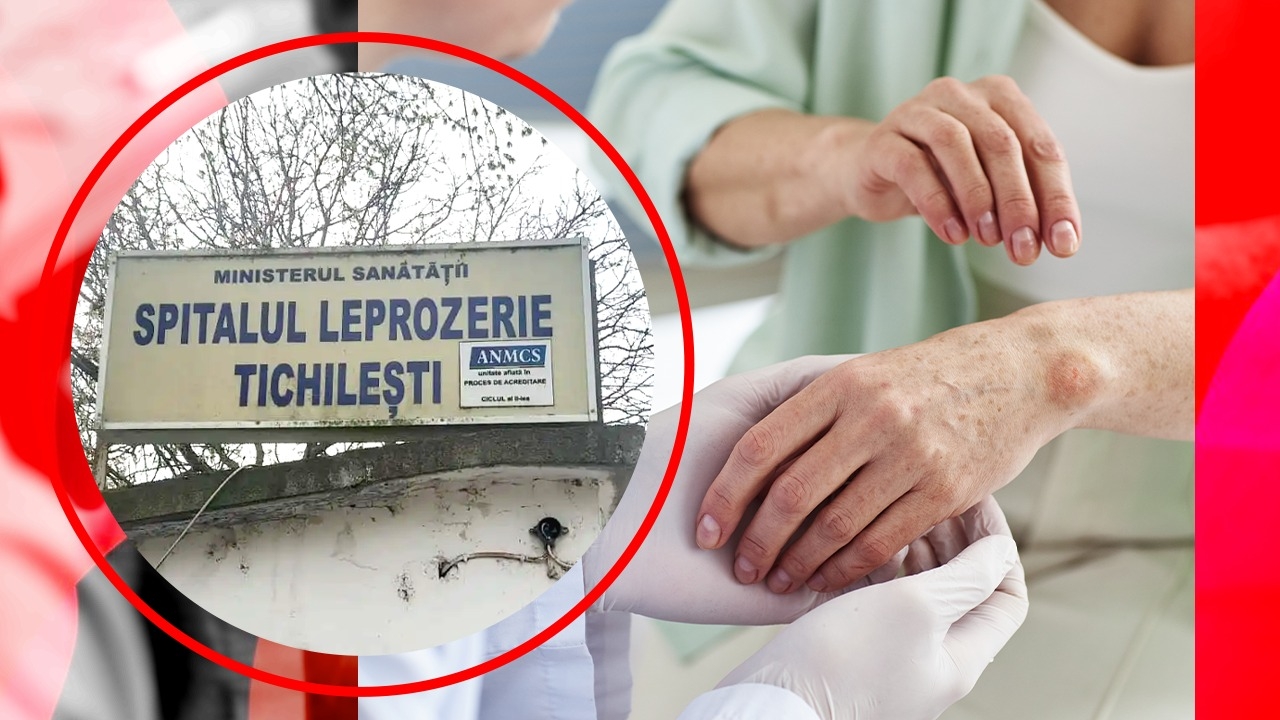Leprozeria de la Tichilești: de la inaugurare la revoltă. Un episod șters din memoria României