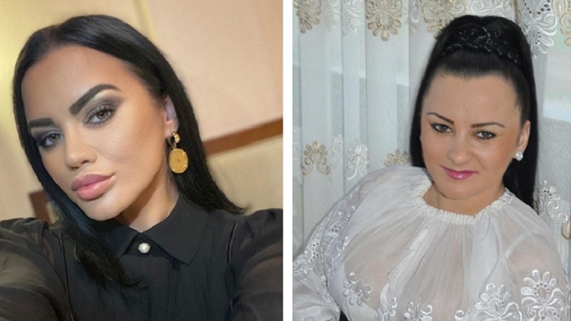 Care este prima intervenție estetică la care a apelat Carmen de la Sălciua. Nimeni nu a știut până acum!