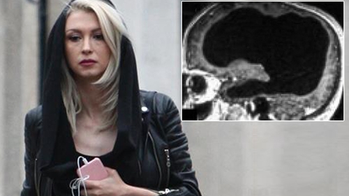 Andreea Bălan, complicații după stop-cardiac. A fost creierul afectat?! "Am făcut două RMN-uri"