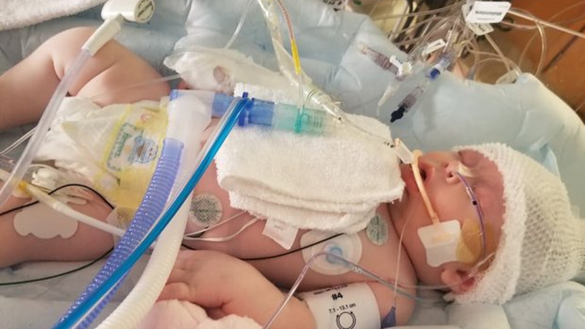 Fetita de 7 saptamani, intre viata si moarte dupa ce tatal a facut un gest banal! Ce i-au gasit medicii in trup. Oricarui parinte i se poate intampla asta